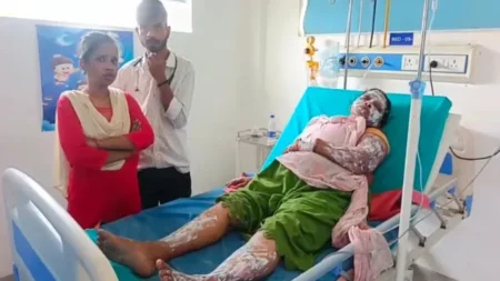 रुद्रपुर में गैस सिलेंडर ब्लास्ट: 5 झुलसे, 4 की हालत गंभीर